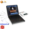 Highness Value 4D Portable Color Doppler Ultrasound