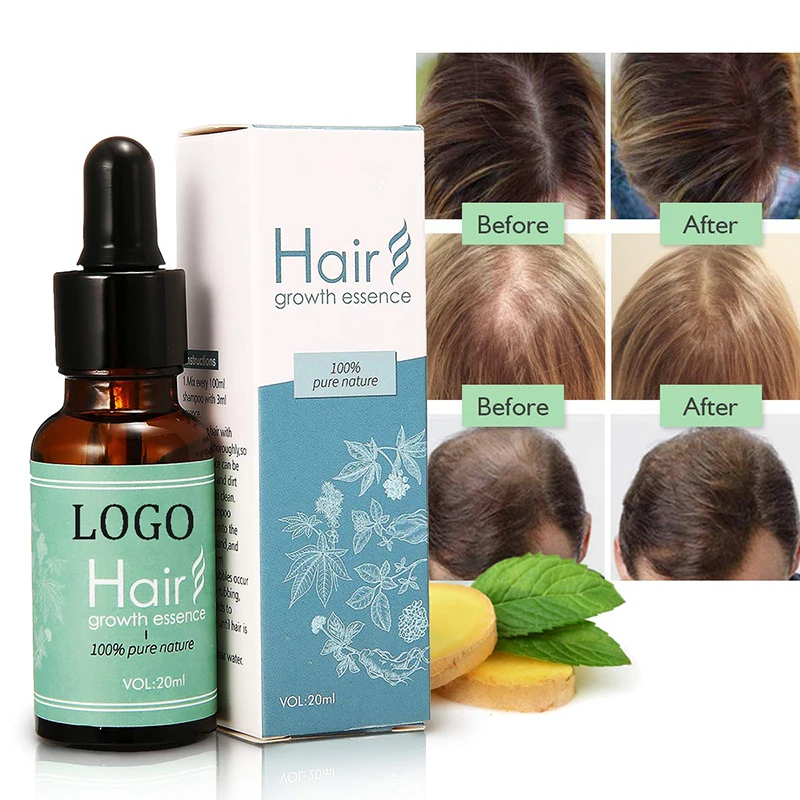 oem hair loss prevention treatment essence natural hair growth