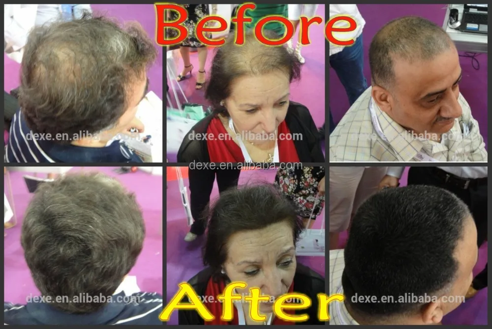 Dexe Hair Thickening Powder For Thinning Hair Build Up Your