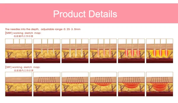 hot sale  ISO13485 approval hifu SMAS non surgical clinic use with UK hifu probe for facial massage body slimming skin tightening hifu Vmax machine