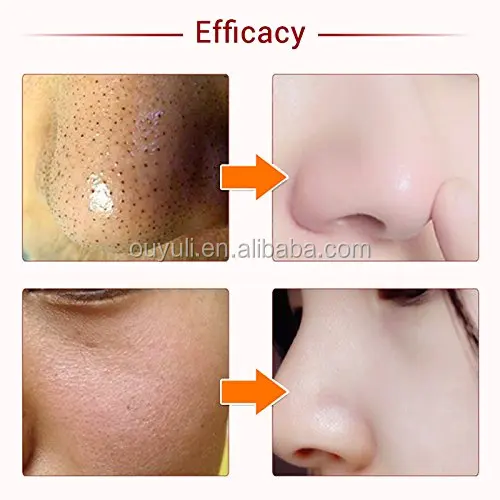 Pin on средства ,которые хороши по отзывам Shampoo bottle, Hand soap bottle, Sha