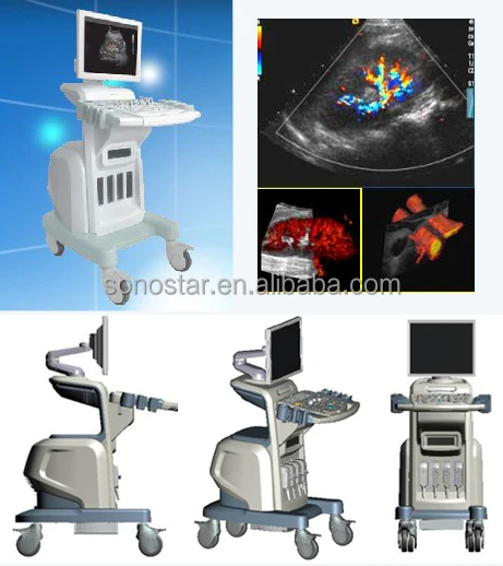 
Color Ultrasound Doppler Machine with Trolley SS-2000 Sonostar Manufacturer 