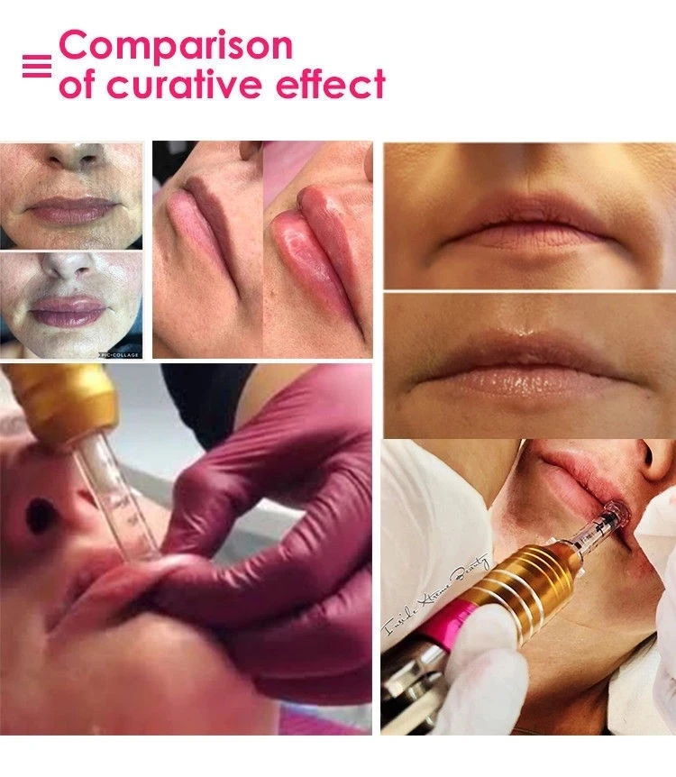 hyaluronic pen (6).jpg
