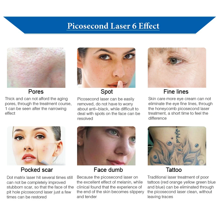 Picosecond Laser Beauty Instrument Nd Yag Laser Tattoo Removal 1064 / 532 / 755 nm Laser Machine