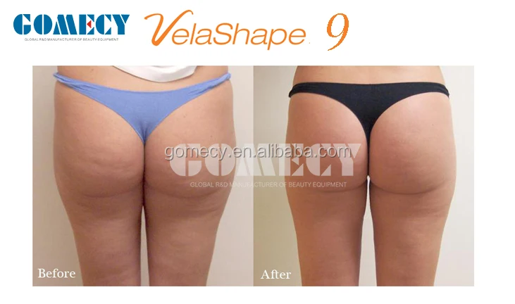 GOMECY 1000W RF+ BIO + 2*40 K cavitation + vacuum + IR + BIO velashape lipo laser body shape beauty machine.jpg