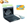 Full-digital Notebook Ultrasound Scanner/ultrasound linear array/laptop ultrasound scanner