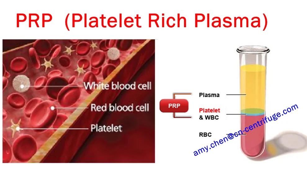 Rich plasma