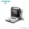 SonoScape S6 low price Expert Portable Ultrasound machine with advanced software kits and 2 probes