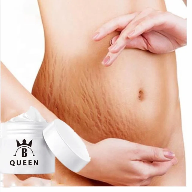 

OEM Natural Herbal Extract Body Skin Acne Scar Stretch Marks Removal Cream