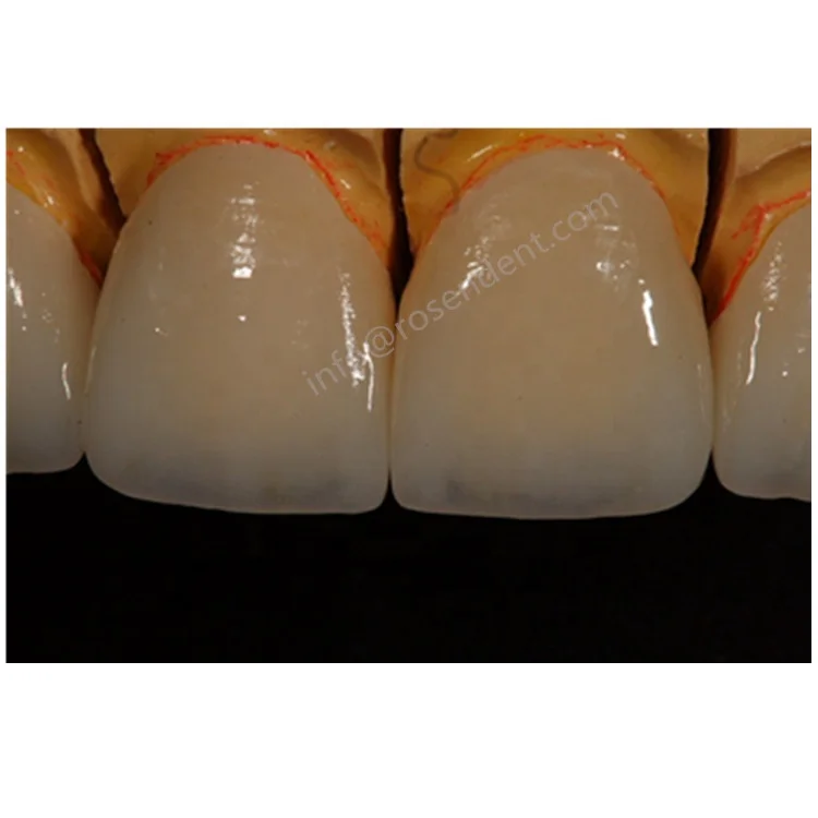 牙科玻璃陶瓷,玻璃陶瓷牙_大山谷图库