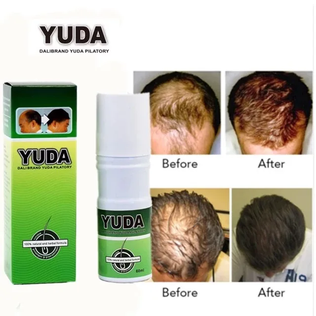 

Yuda Brand Baldness treatment growth hair oil