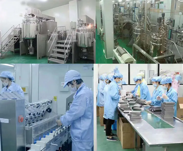 Silhouette thread lift 19g 50mm nose lift thread apto pdo face lift thread