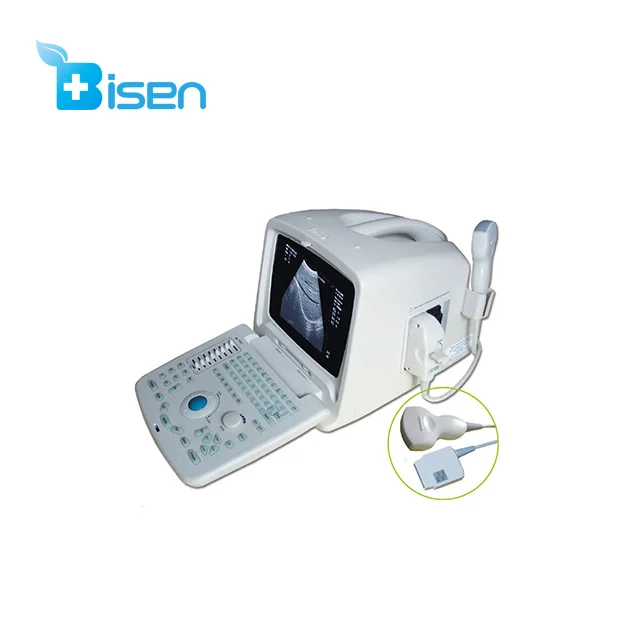 
Cheap powerful function ultrasound scanner with convex array probe pretty and portable appearance 