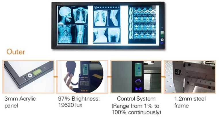 x-ray film viewer led x-ray film light box medical led x ray negatoscope