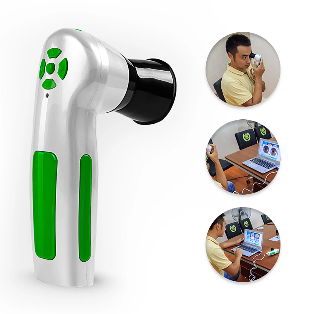 

2017 12.0 Megapixel digital iriscope/ iridology camera eye iriscope