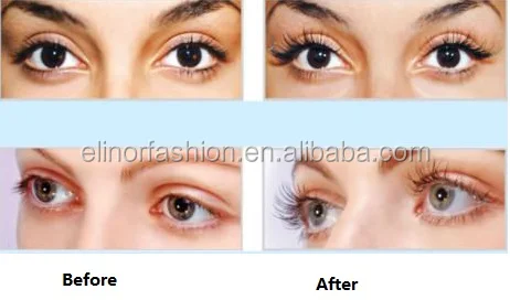 before and after 0709-2