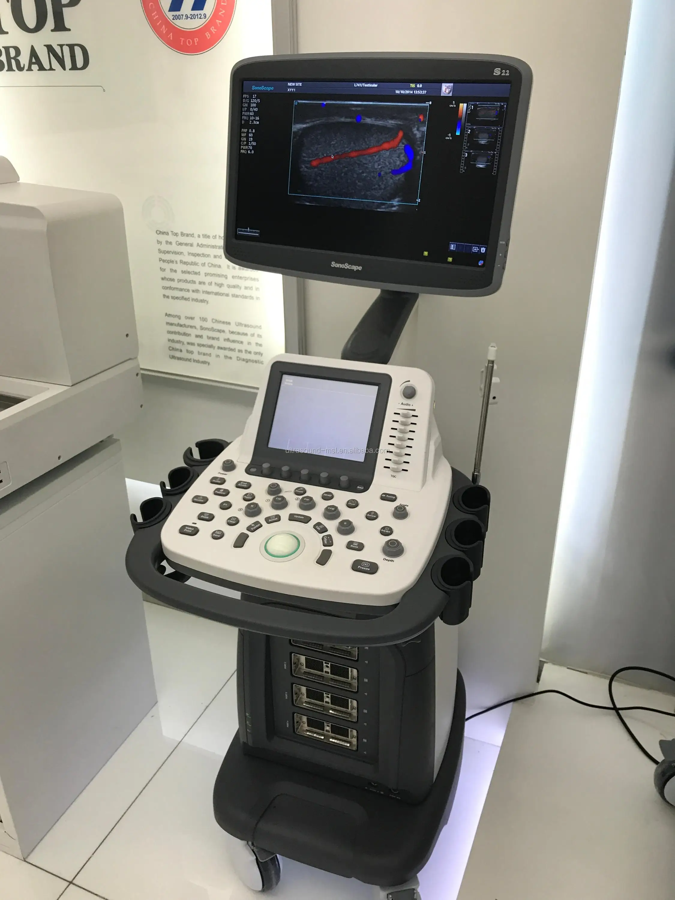 Powerful Workflow Steer M/tdi/imt Cardiology Usg Sonoscape S22 Color ...