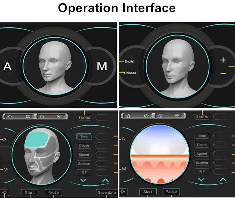 rf needle machine.jpg