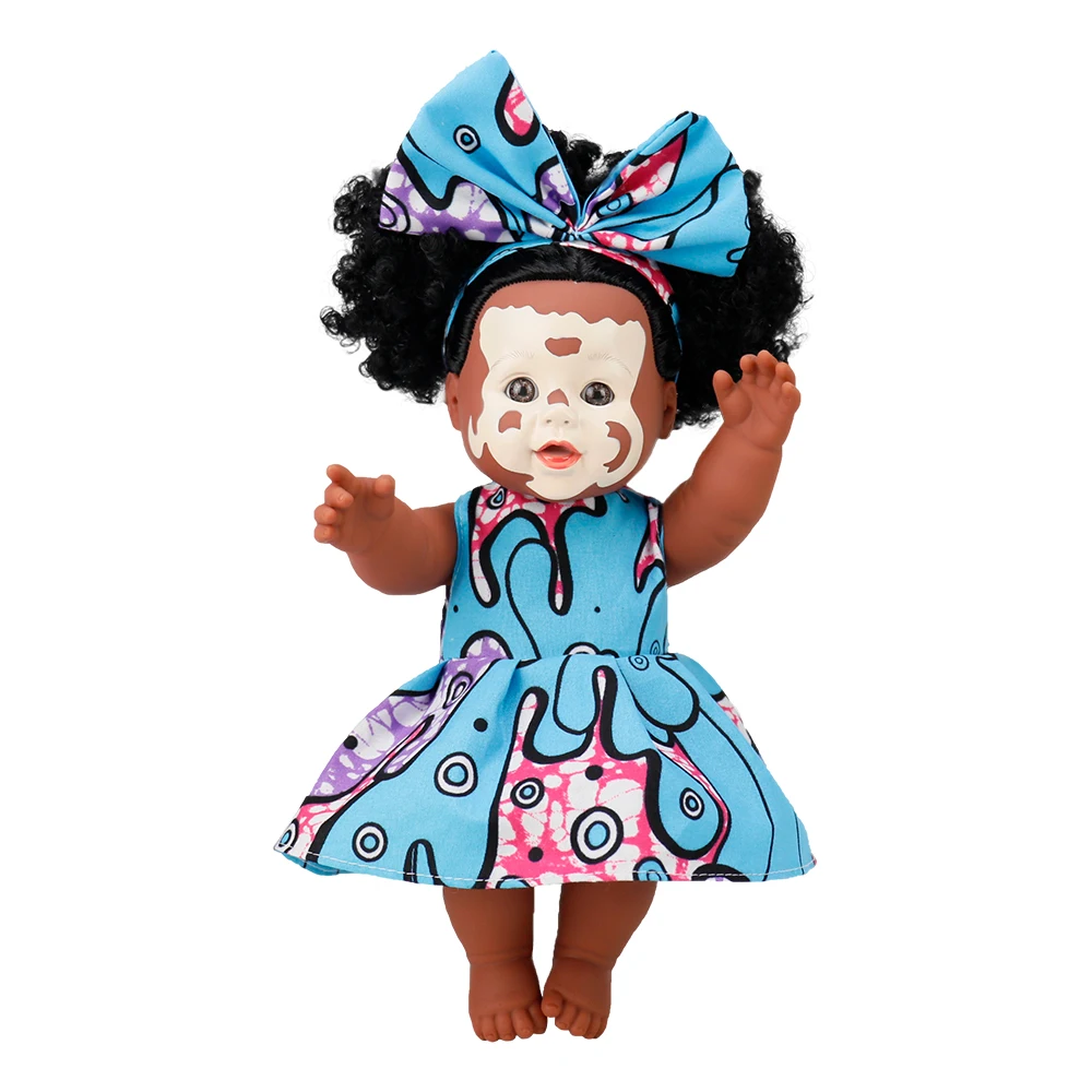 Wholesale Vinyl Vitiligo Doll 12 Inch Lifelike African American Black