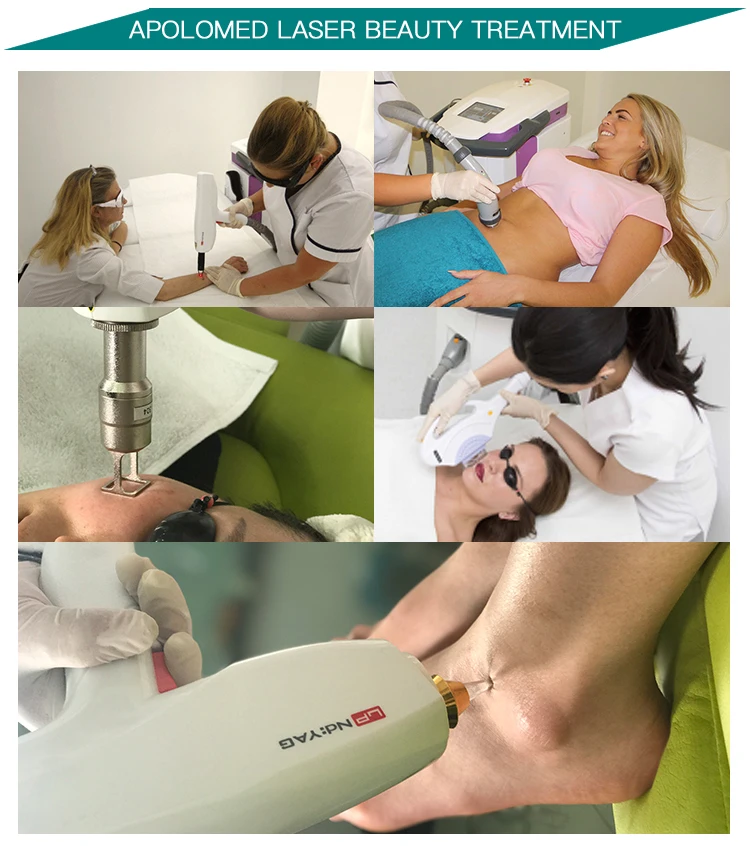 IPL RF and laser platform long pulse nd yag hair removal 