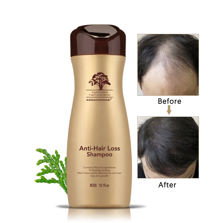 Effective Herbal Ingredient Make Hair Grow Faster 2019 Best Seller Healthy Hair Repair And Growth Shampoo