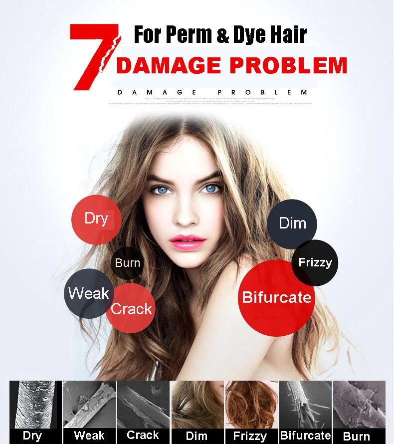 LPP2