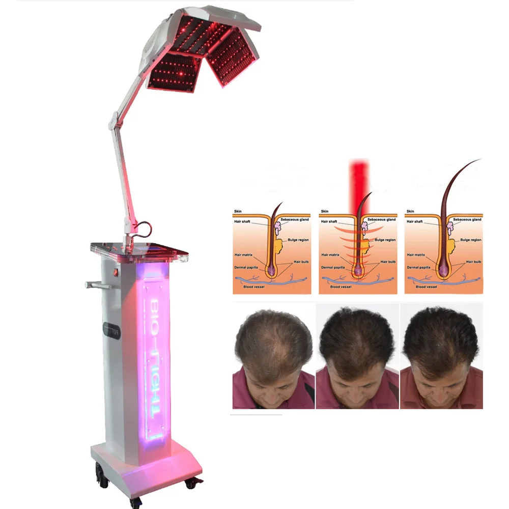 Hot Sale Laser Hair Regrowth Hair Loss Treatment 650nm Laser