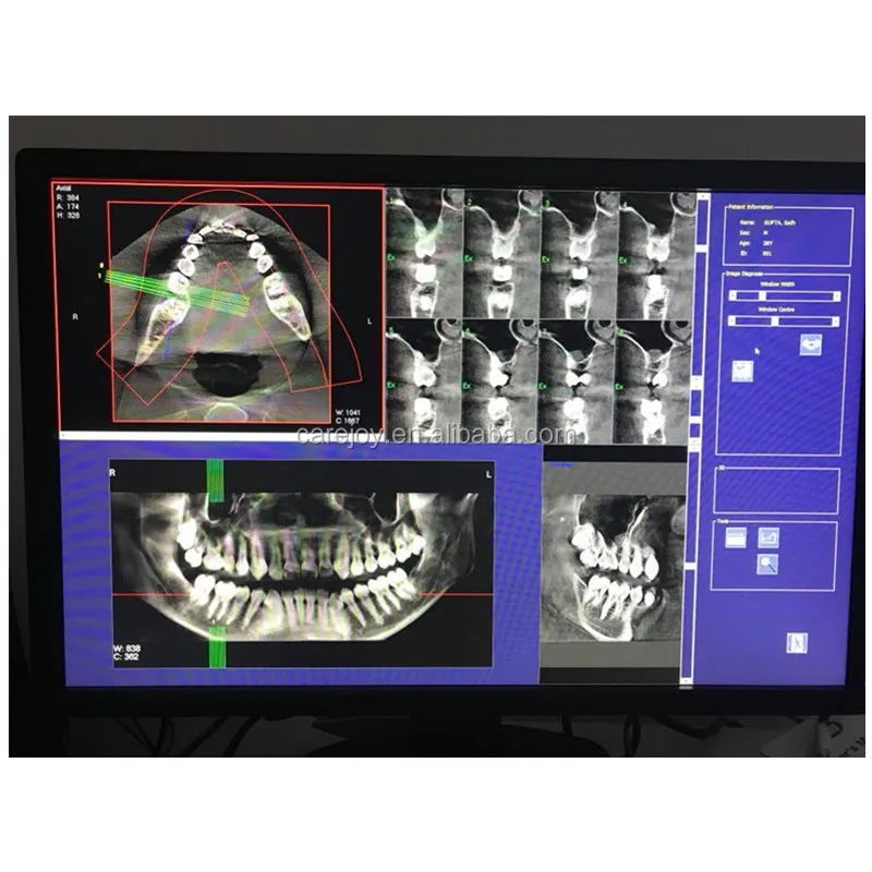 Dental Cbct Digital Dental X Ray Machine For Oral And Maxiloacial