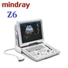 Mindray Z6 cost effective color doppler ultrasound portable mindray
