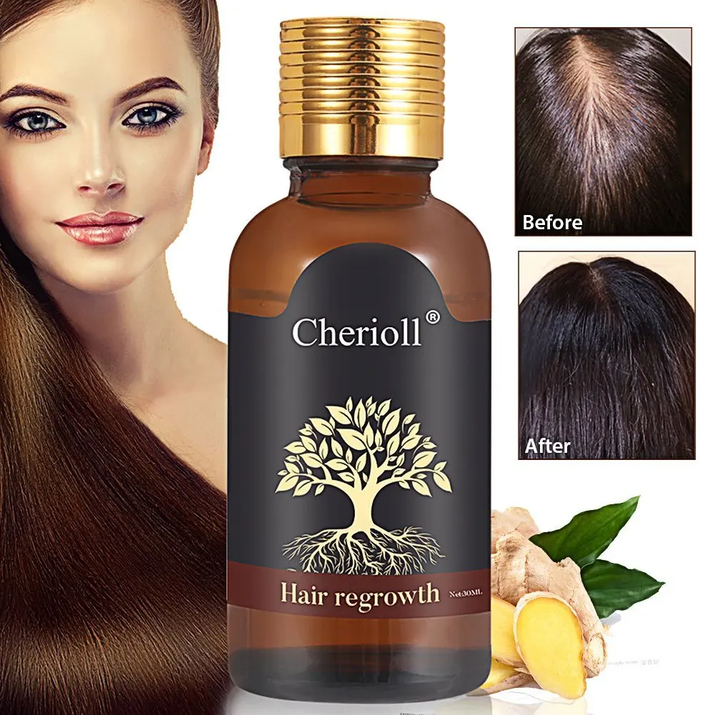 Cheap Best Hair Growth Treatment, find Best Hair Growth Treatment deals