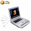 Hospital Medical equipment 3D/4D laptop clear images ultrasound device