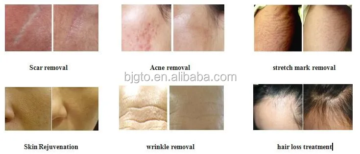 before and after.jpg