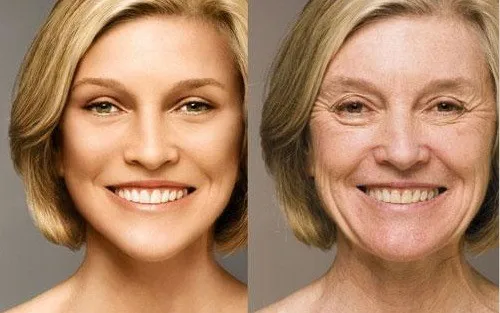 Portable Ipl Shr Hair Removal &amp; Skin Rejuvenation Ipl Equipment,Hair