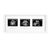 White 8x17 Triple Sonogram Pregnancy Keepsake Frame Through All Three Trimesters Watch Baby Grow Great Gift