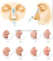 

Injectable Hyaluronic Acid Filler for Humpping Nose