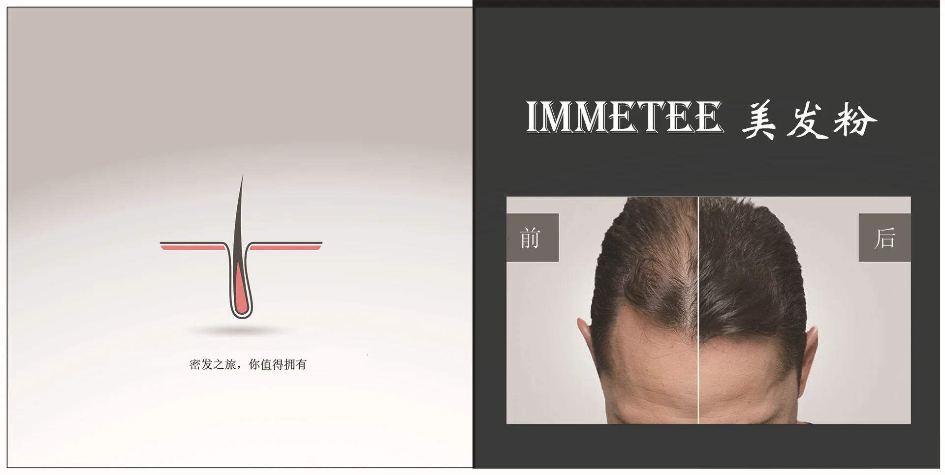Wholesale Hair Regrowth Oil For Men Immetee Hair Fiber Spray Buy