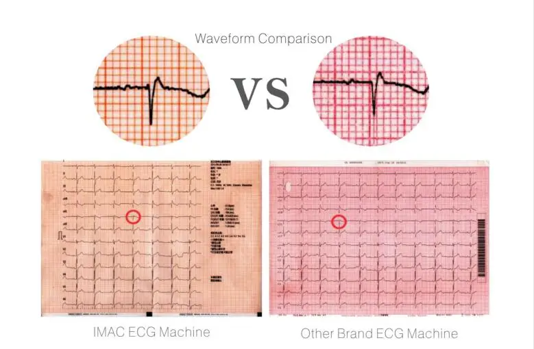 Portable 12 Channel ECG machines mac compatible