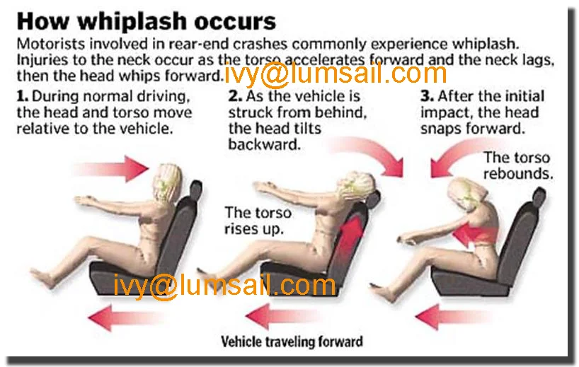 Rear end перевод. Forward and backward Tilt. What is Whiplash. Extension component of Whiplash,. Whiplash injury lawyer around los Angeles.