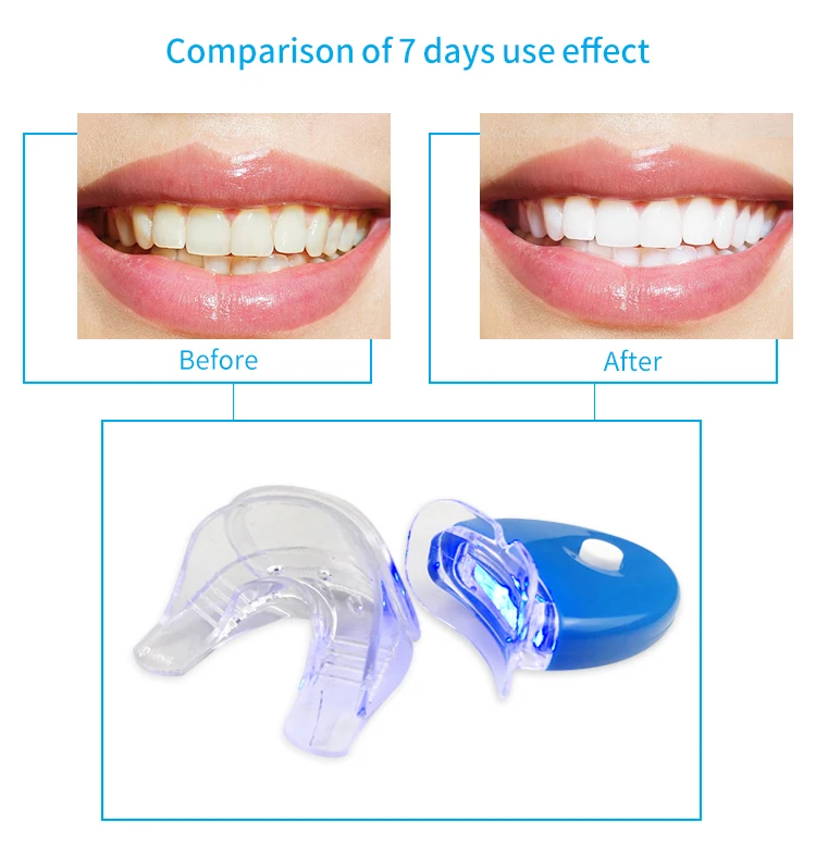 Blue Led Light Teeth Whitening Home Teeth Whitening Led Light Buy
