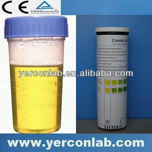 
ketone test strips 