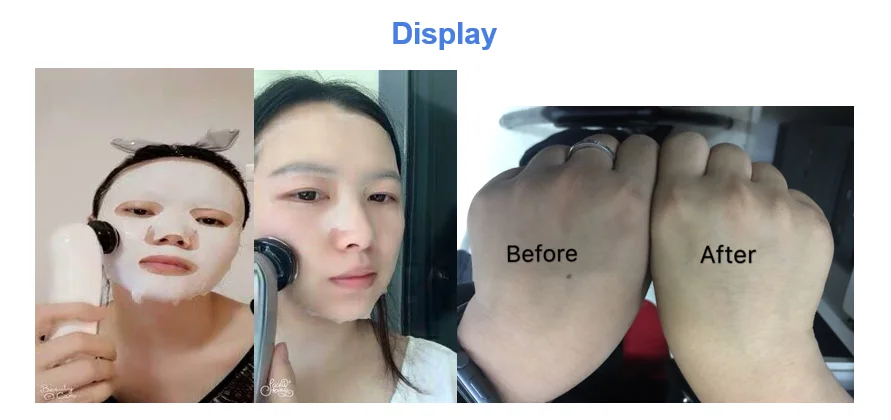New Brand Lifting Machine Ems Up Rf Facial Skin Lifting Device Cheap Rf Beauty Salon EquipmenT Wrinkle Removal Device Rf