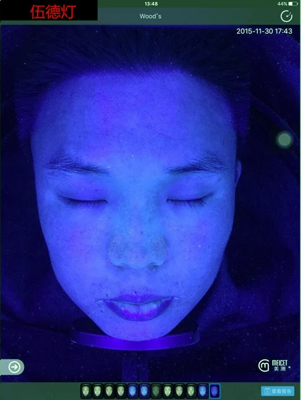 skin test analysis machine / 3d professional skin