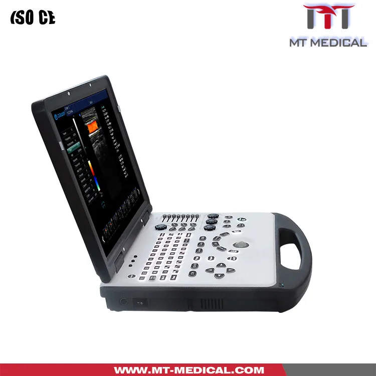 Ultrasonic 3D/4d color Doppler Ultrasound System Doppler Color Ultrasound Machine