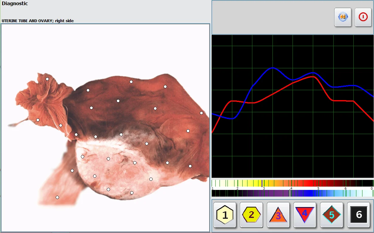 2021 Latest Professional 2 in 1 Touch Screen Metatron NLS Metapathia GR Hunter 4025