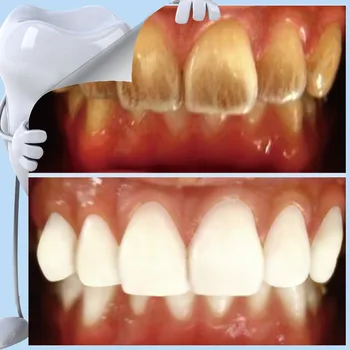 dientes