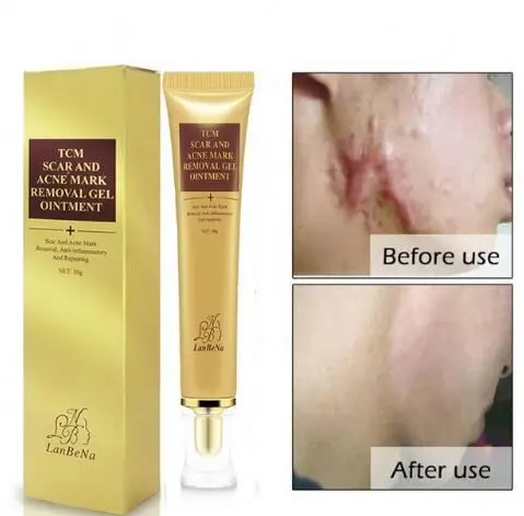 

Skin Care Repair Face Cream LANBENA EGF Remover Scar Cream Stretch Mark Gel Anti Acne Cream Acne Treatment dropshipping