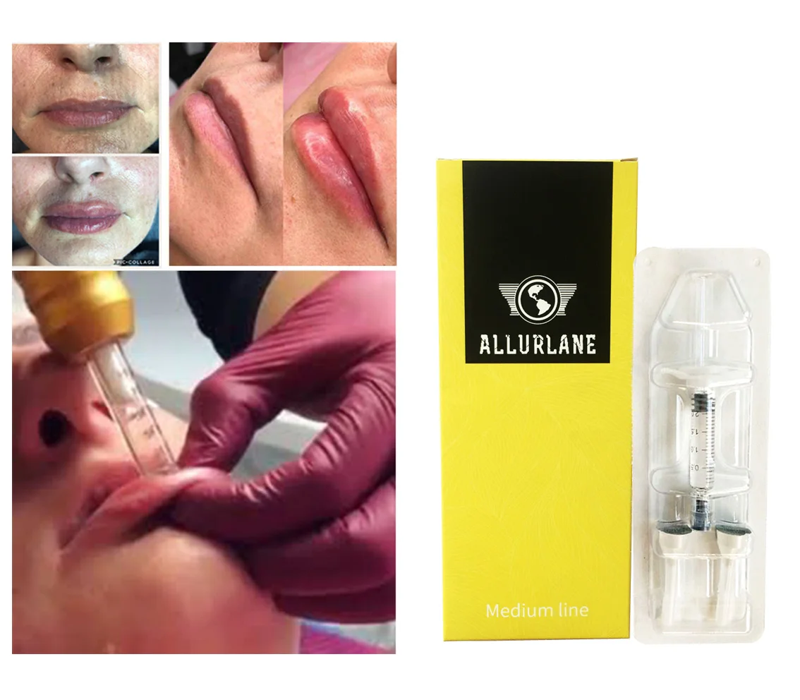 

pen filler 2m/syringel dermal filler for lips filling