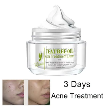 Japanese Acne Treatment Free Gel Best Acne Cream For Acne Removal - Buy