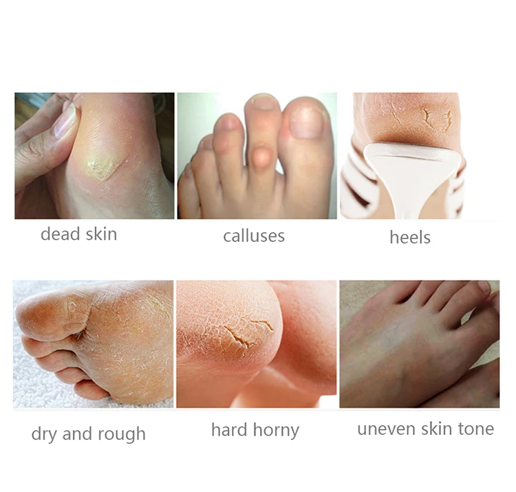 Hand and foot mask_llll