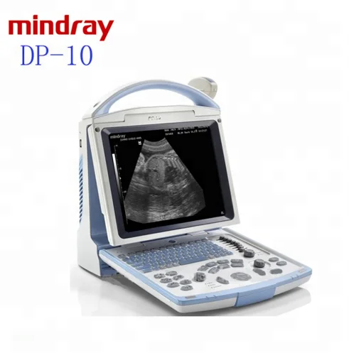 
2019 Cheap ultrasound scanner Mindray DP10 with ultrasound printer  (60779871700)